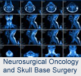 Neurosurgical Oncology and Skull Base Surgery